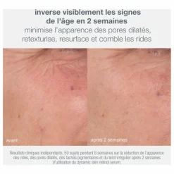 Coffret anti-âge et fermeté