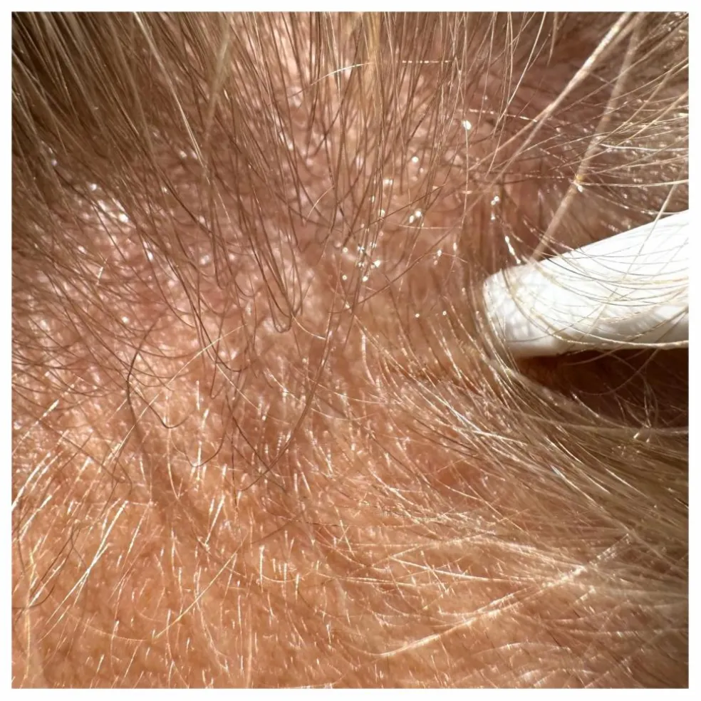Serum cheveux - Pure Growth - 100 ml